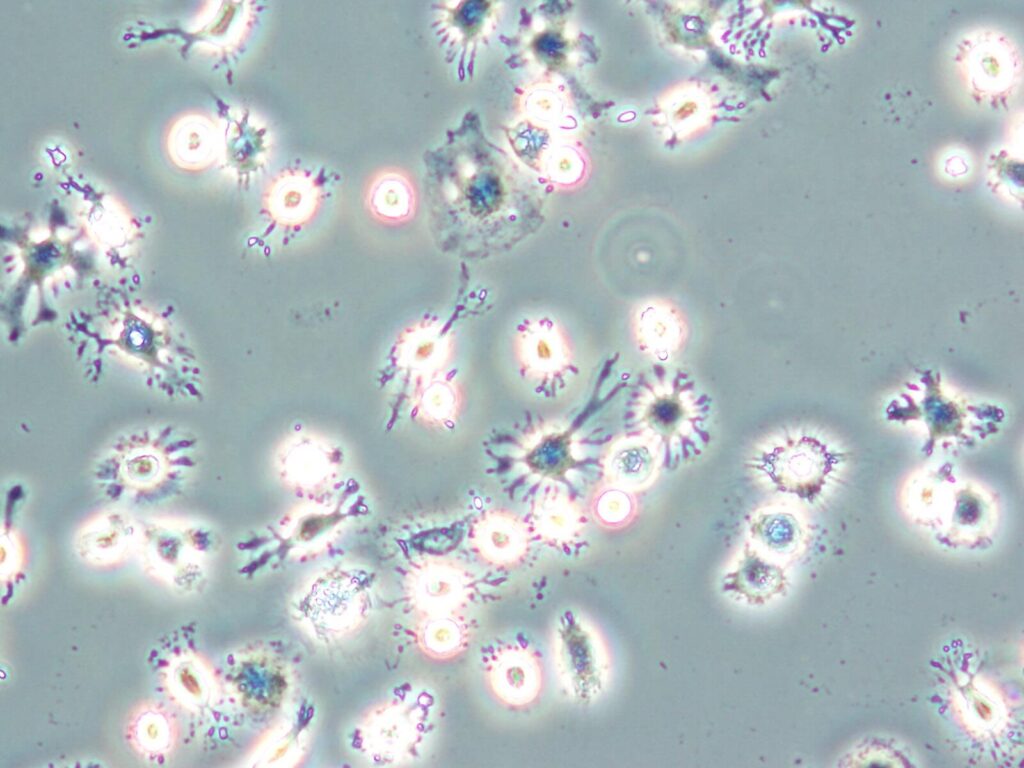 培養した樹状細胞の光学顕微鏡写真