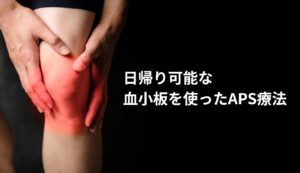 変形性膝関節症に対する血小板を使った再生医療とは